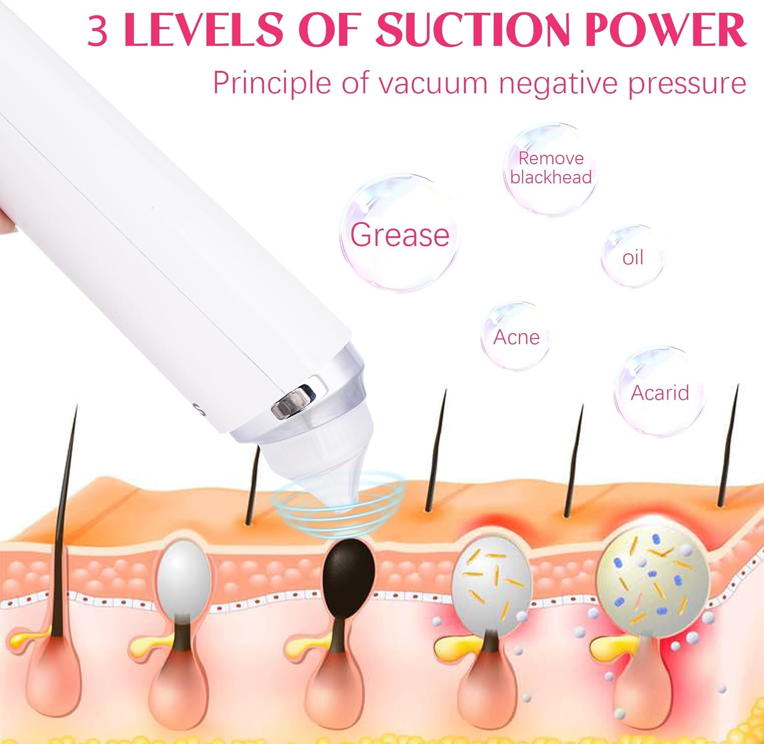 Pore Vacuum Black Head Remover for Face WIFI Visible Facial Pimple Extractor with 6 Suction Heads and HD Camera USB Rechargeable Electric Pore Cleaner Tool for Women